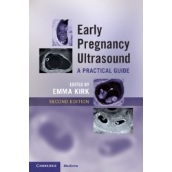 Early Pregnancy Ultrasound: A Practical Guide