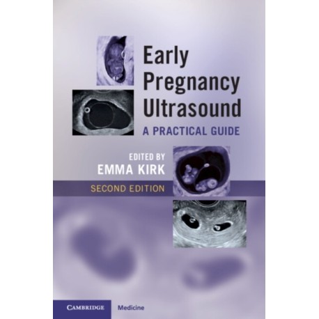Early Pregnancy Ultrasound: A Practical Guide