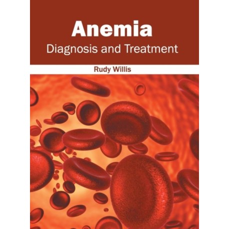Anemia: Diagnosis and Treatment