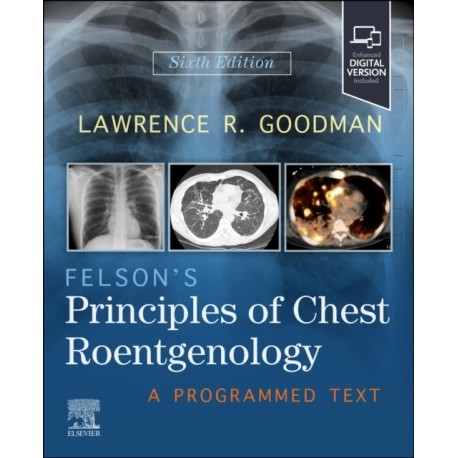 Felson's Principles of Chest Roentgenology: A Programmed Text