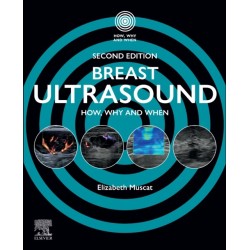 Breast Ultrasound: How, Why and When