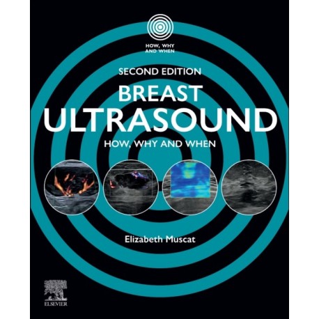 Breast Ultrasound: How, Why and When