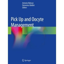 Pick Up and Oocyte Management
