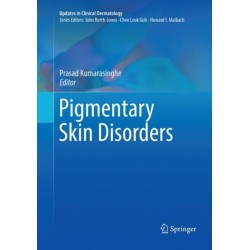 Pigmentary Skin Disorders