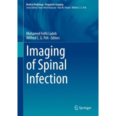 Imaging of Spinal Infection