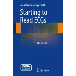 Starting to Read ECGs: The Basics