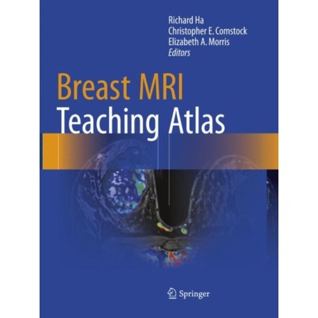 Breast MRI Teaching Atlas