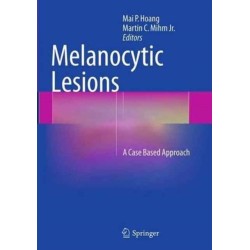 Melanocytic Lesions: A Case Based Approach