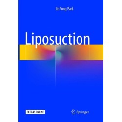 Liposuction