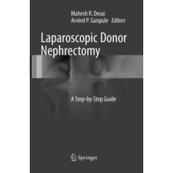 Laparoscopic Donor Nephrectomy: A Step-by-Step Guide