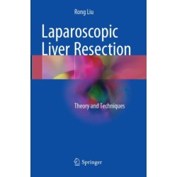 Laparoscopic Liver Resection: Theory and Techniques
