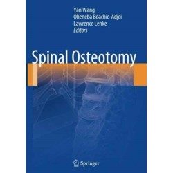Spinal Osteotomy