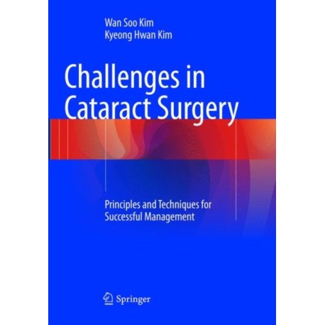 Challenges in Cataract Surgery: Principles and Techniques for Successful Management