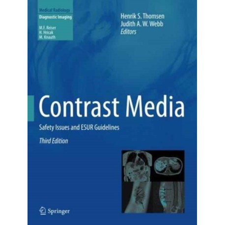 Contrast Media: Safety Issues and ESUR Guidelines
