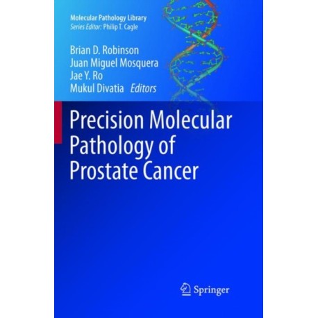 Precision Molecular Pathology of Prostate Cancer