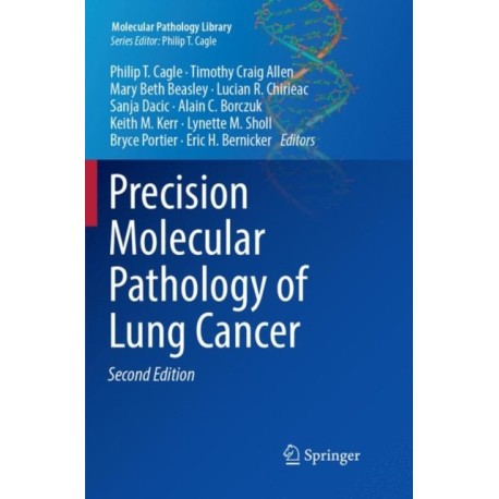 Precision Molecular Pathology of Lung Cancer