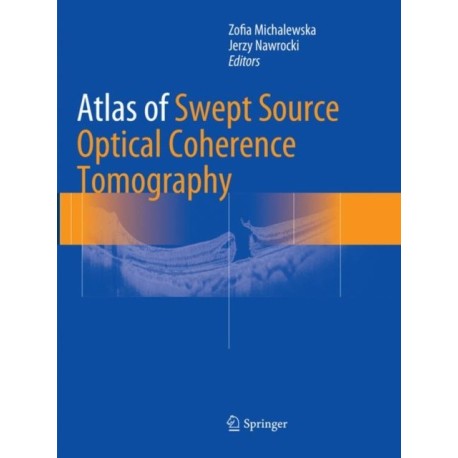 Atlas of Swept Source Optical Coherence Tomography