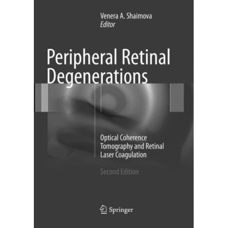 Peripheral Retinal Degenerations: Optical Coherence Tomography and Retinal Laser Coagulation