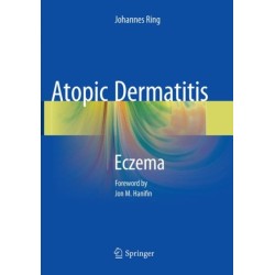 Atopic Dermatitis: Eczema