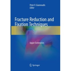 Fracture Reduction and Fixation Techniques: Upper Extremities