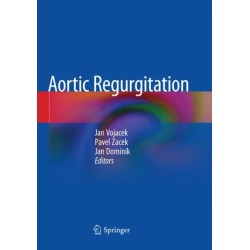 Aortic Regurgitation