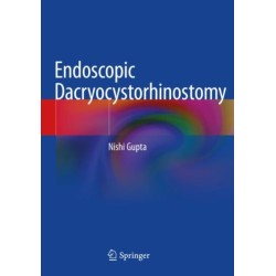 Endoscopic Dacryocystorhinostomy