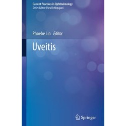 Uveitis