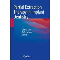 Partial Extraction Therapy in Implant Dentistry