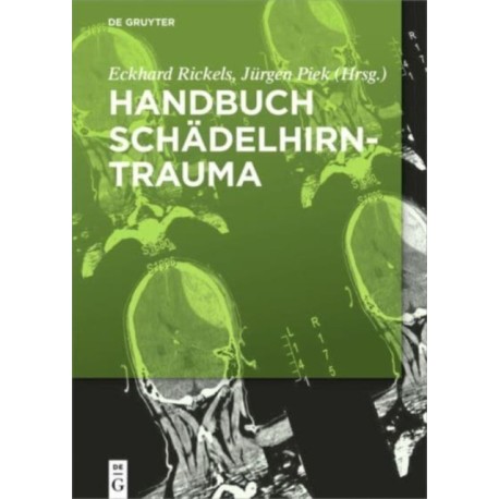 Handbuch Schadelhirntrauma