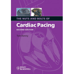 The Nuts and Bolts of Cardiac Pacing