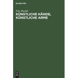 Kunstliche Hande, Kunstliche Arme