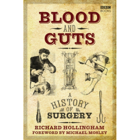 Blood and Guts: A History of Surgery