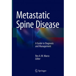 Metastatic Spine Disease: A Guide to Diagnosis and Management
