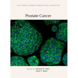 Prostate Cancer