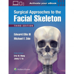 Surgical Approaches to the Facial Skeleton