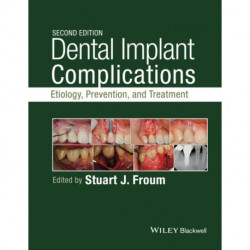 Dental Implant Complications: Etiology, Prevention, and Treatment