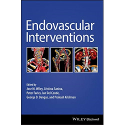 Endovascular Interventions