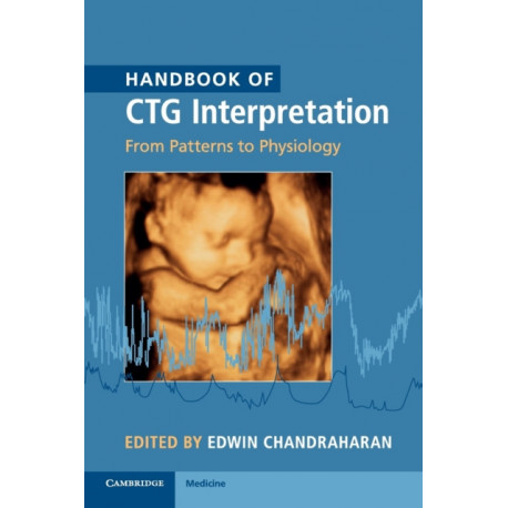 Handbook of CTG Interpretation: From Patterns to Physiology