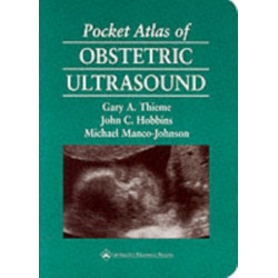 Pocket Atlas of Obstetric Ultrasound