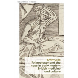 Rhinoplasty and the Nose in Early Modern British Medicine and Culture