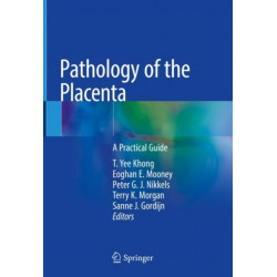 Pathology of the Placenta: A Practical Guide