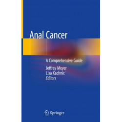 Anal Cancer: A Comprehensive Guide
