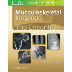 Musculoskeletal Imaging: The Essentials