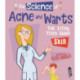 The Science Of Acne & Warts: The Itchy Truth About Skin