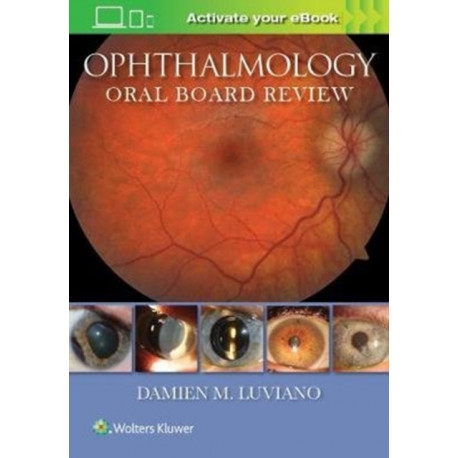 Ophthalmology Oral Board Review