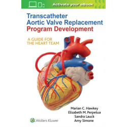 Transcatheter Aortic Valve Replacement Program Development: A Guide for the Heart Team