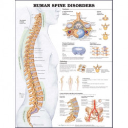 Human Spine Disorders Anatomical Chart