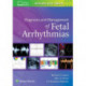 Diagnosis and Management of Fetal Arrhythmias