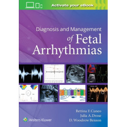 Diagnosis and Management of Fetal Arrhythmias