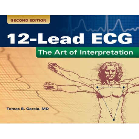 12-Lead ECG: the Art of Interpretation: The Art of Interpretation